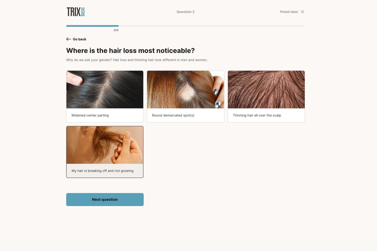 Hair loss? Find your supplements - TRIX Basic Hair Quiz